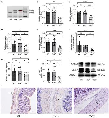 Role of GDNF, GFRα1 and GFAP in a Bifidobacterium-Intervention Induced Mouse Model of Intestinal Neuronal Dysplasia